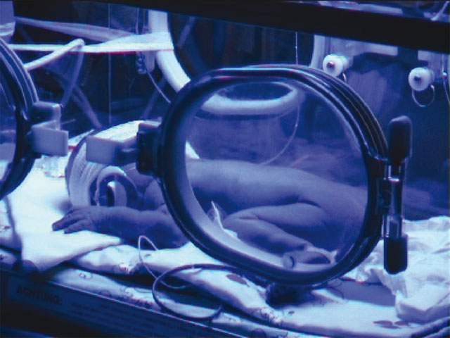 Premature baby sleeping in an incubator, listening to the music therapy.