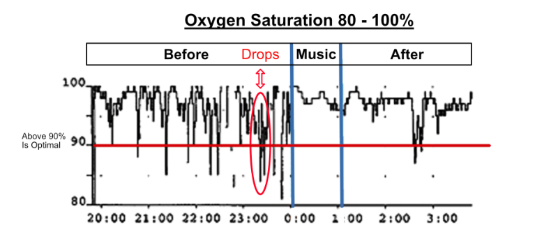 This graph is an example of the oxygen saturation drops that can occur on premature babies. It also shows how preemie music therapy can help to improve and stabilise oxygen saturation.